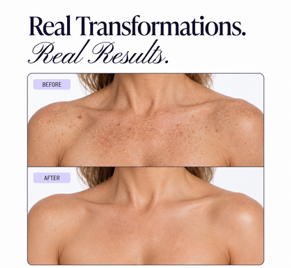 Solvori Skin Veil™ – Instant Body Coverage Giving Tan-Like Skin