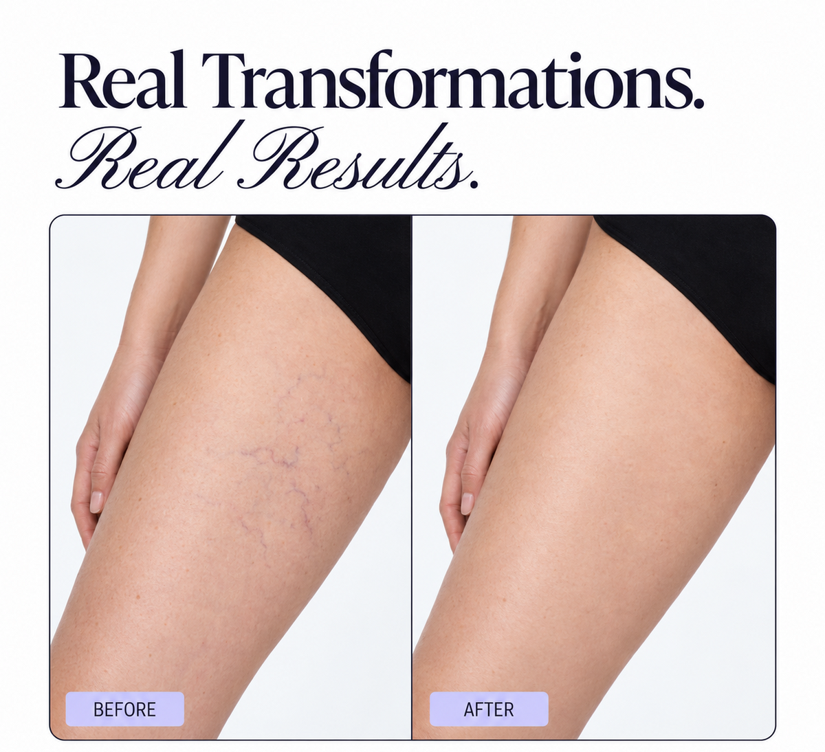 Solvori Skin Veil™ – Instant Body Coverage Giving Tan-Like Skin