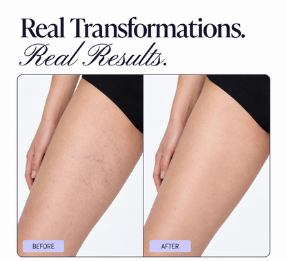 Solvori Skin Veil™ – Instant Body Coverage Giving Tan-Like Skin